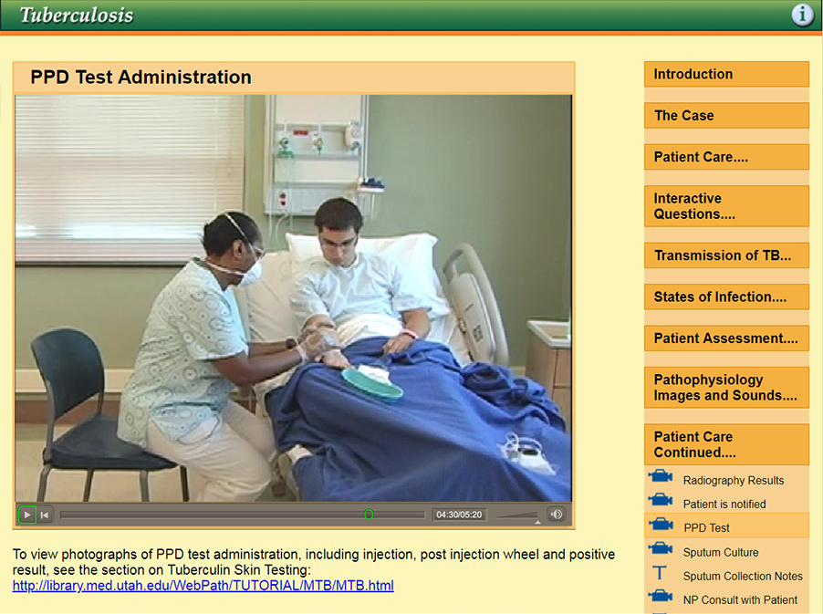 Nurse inserting needle in TB patient to administer the PPD Tuberculin Skin Test